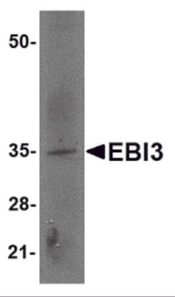 Western blot analysis of EBI3 in rat spleen tissue lysate with EBI3 antibody at 2 μg/mL.