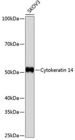 Western blot - Cytokeratin 14 antibody (A19039)