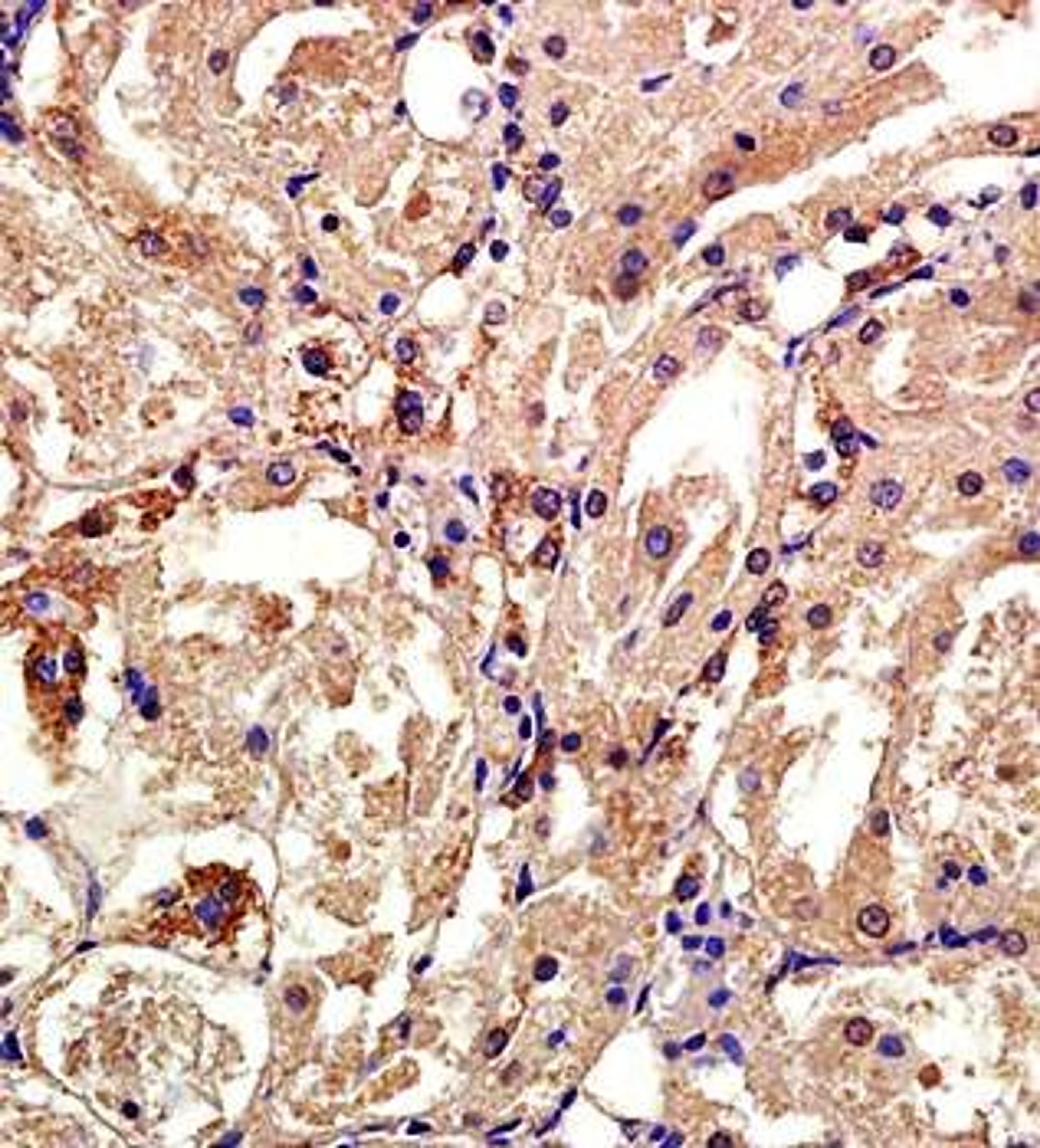 Paraffin-embedded rat kidney tissue fixed with 4% paraformaldehyde. Antigen retrieval by boiling with citrate buffer. Blocking buffer is goat serum (37 degrees for 20 min.). CXCL4 antibody at 1:200 dilution with overnight incubation at 4 degrees