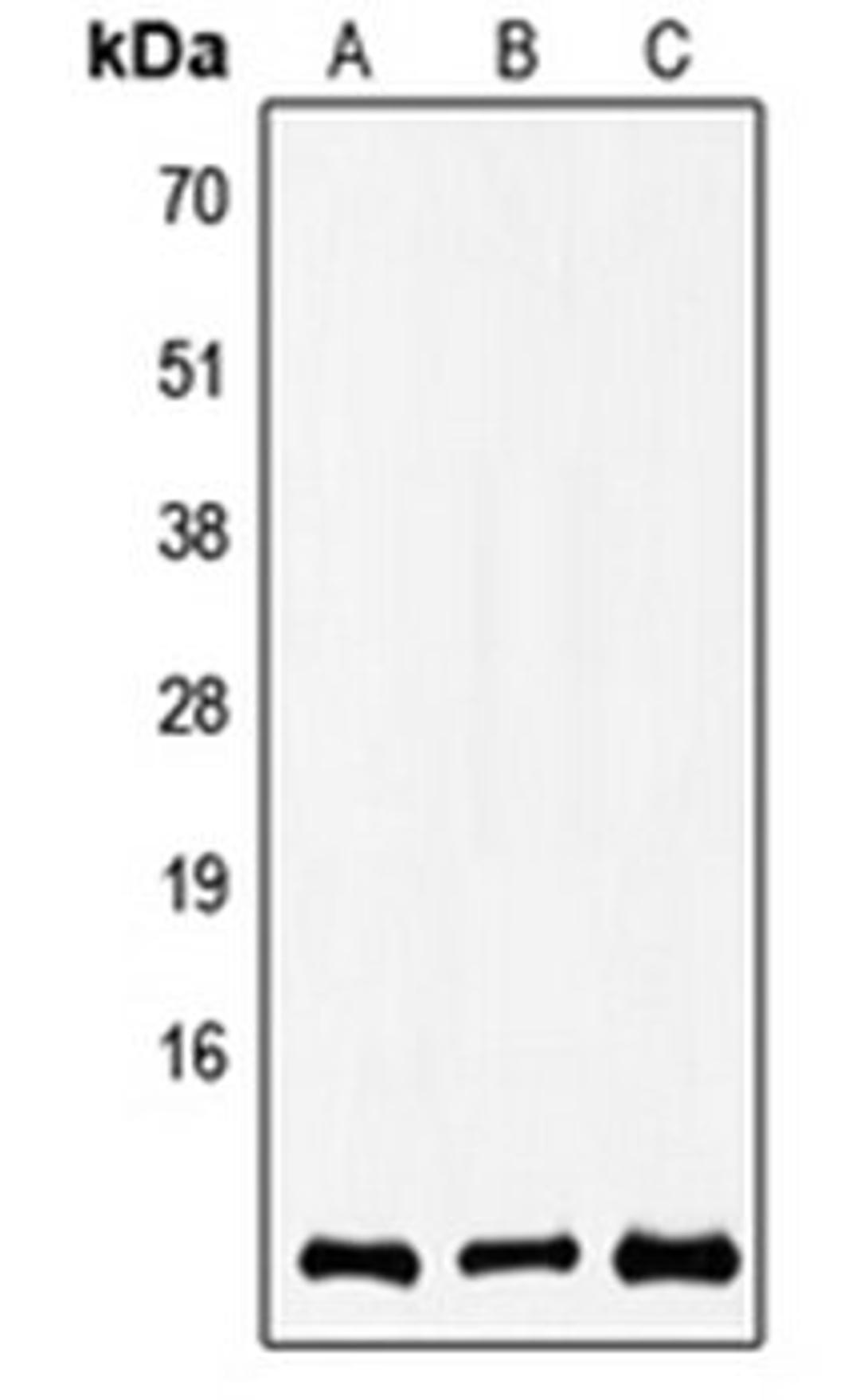 Western blot analysis of A549 (Lane 1), SP2/0 (Lane 2), rat brain (Lane 3) whole cell lysates using COX8A antibody