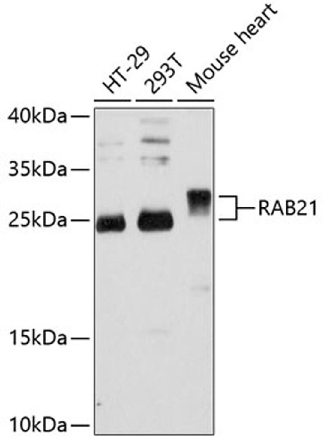 Western blot - RAB21 antibody (A12095)