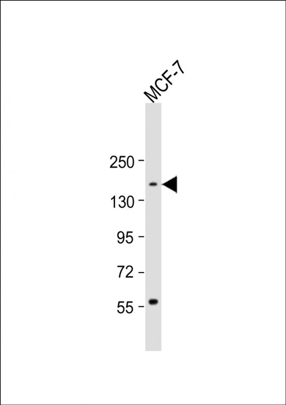 Western Blot at 1:1000 dilution + MCF-7 whole cell lysate Lysates/proteins at 20 ug per lane.