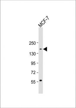 Western Blot at 1:1000 dilution + MCF-7 whole cell lysate Lysates/proteins at 20 ug per lane.