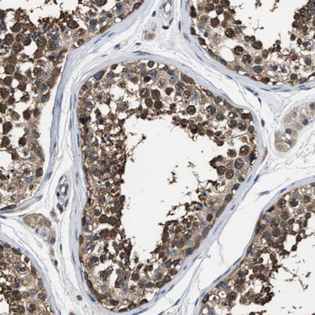 Immunohistochemistry-Paraffin: ABCC9 Antibody [NBP1-84436] - Immunohistochemical staining of human testis shows cytoplasmic positivity in cells in seminiferus ducts.