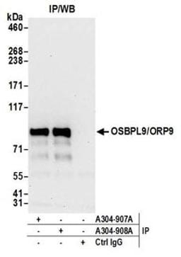 Detection of human OSBPL9/ORP9 by western blot of immunoprecipitates.