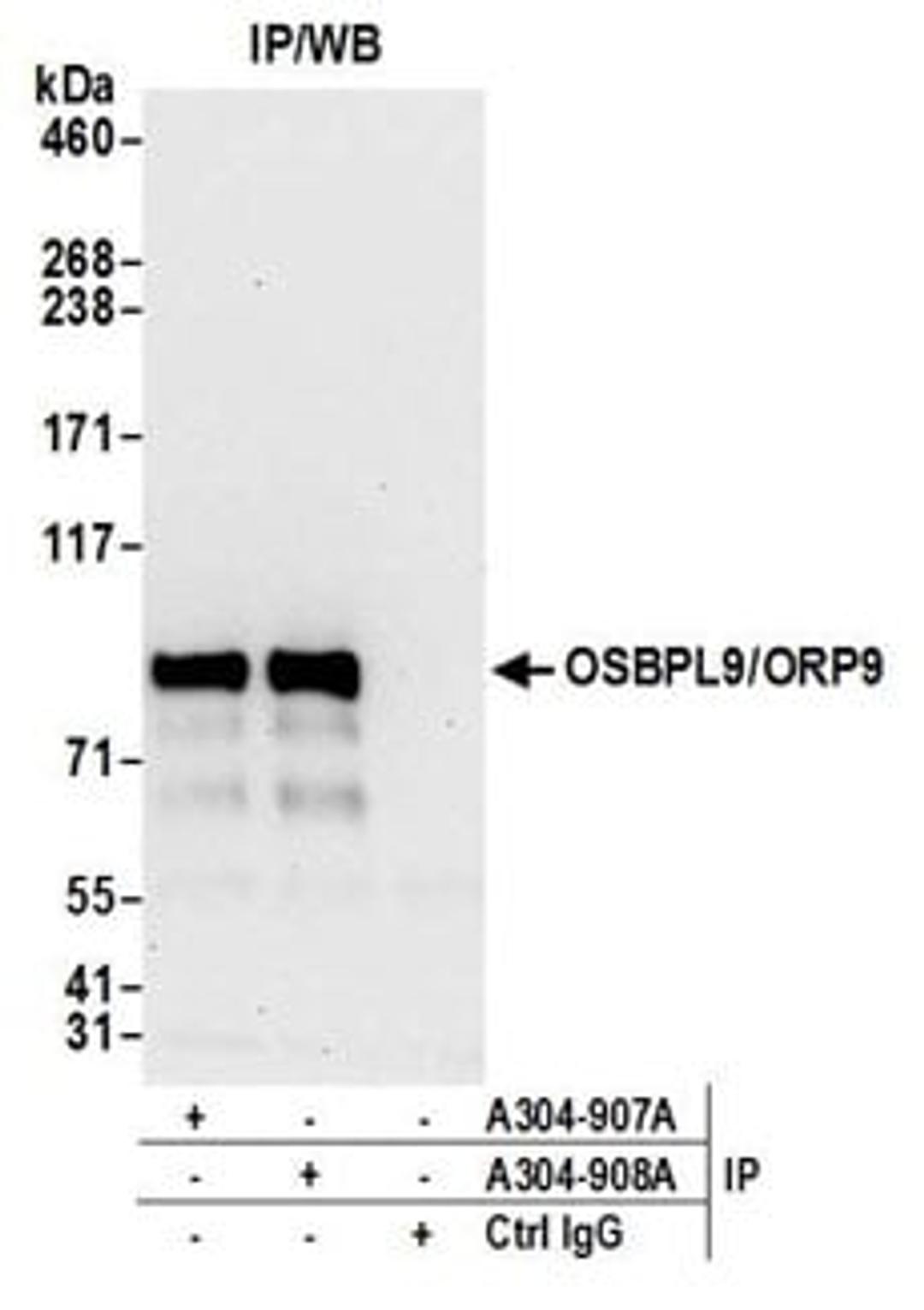 Detection of human OSBPL9/ORP9 by western blot of immunoprecipitates.