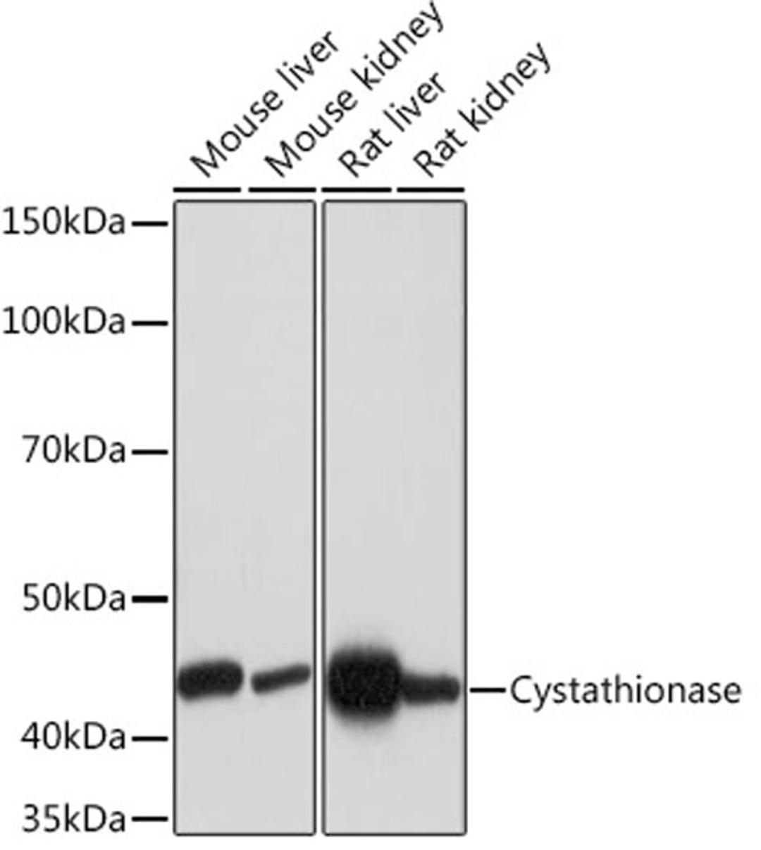 Western blot - Cystathionase Rabbit mAb (A5101)