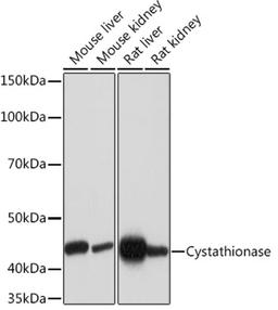 Western blot - Cystathionase Rabbit mAb (A5101)