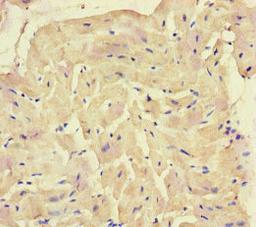 Immunohistochemistry of paraffin-embedded human heart tissue using CSB-PA615696LA01HU at dilution of 1:100
