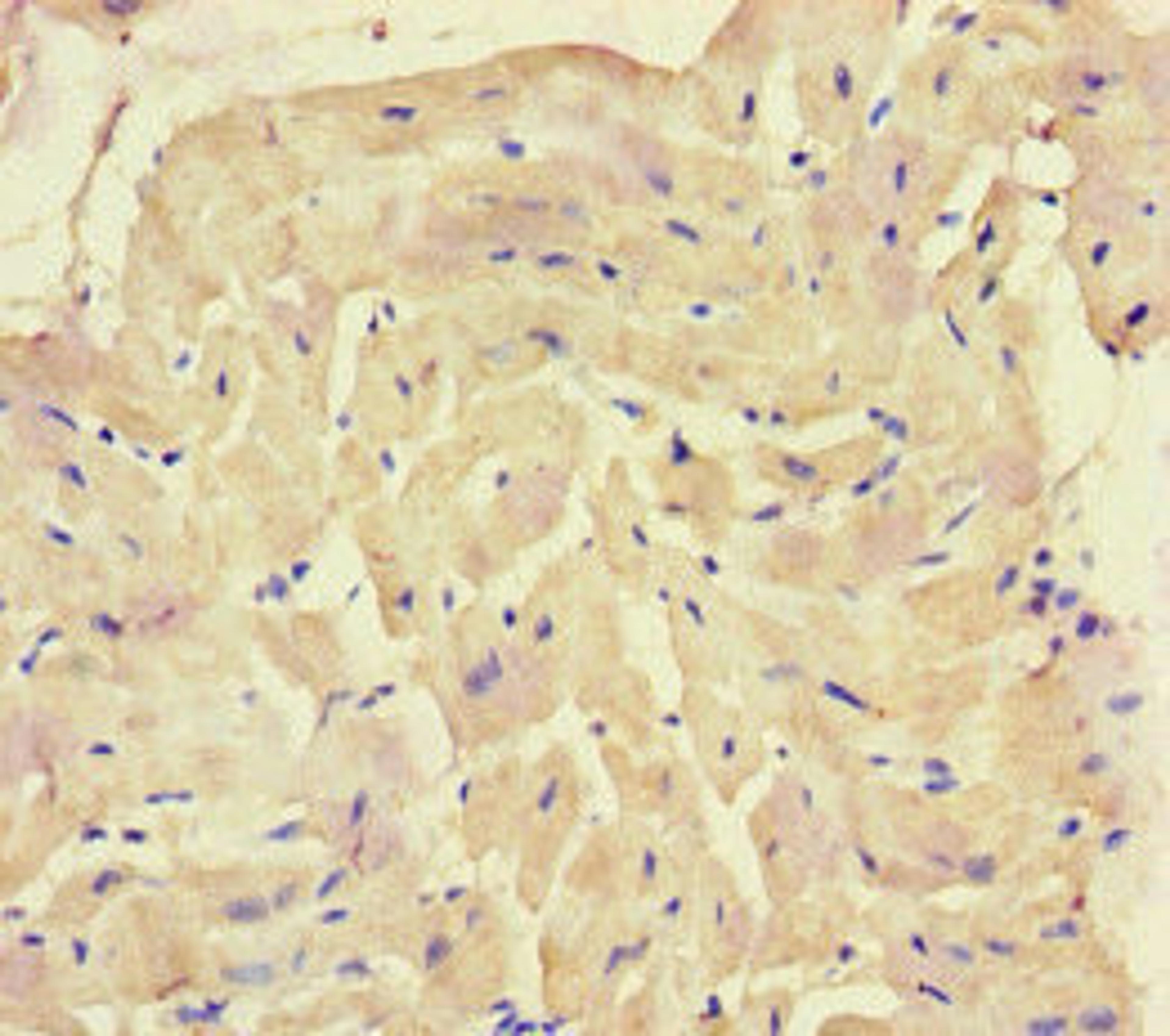 Immunohistochemistry of paraffin-embedded human heart tissue using CSB-PA615696LA01HU at dilution of 1:100