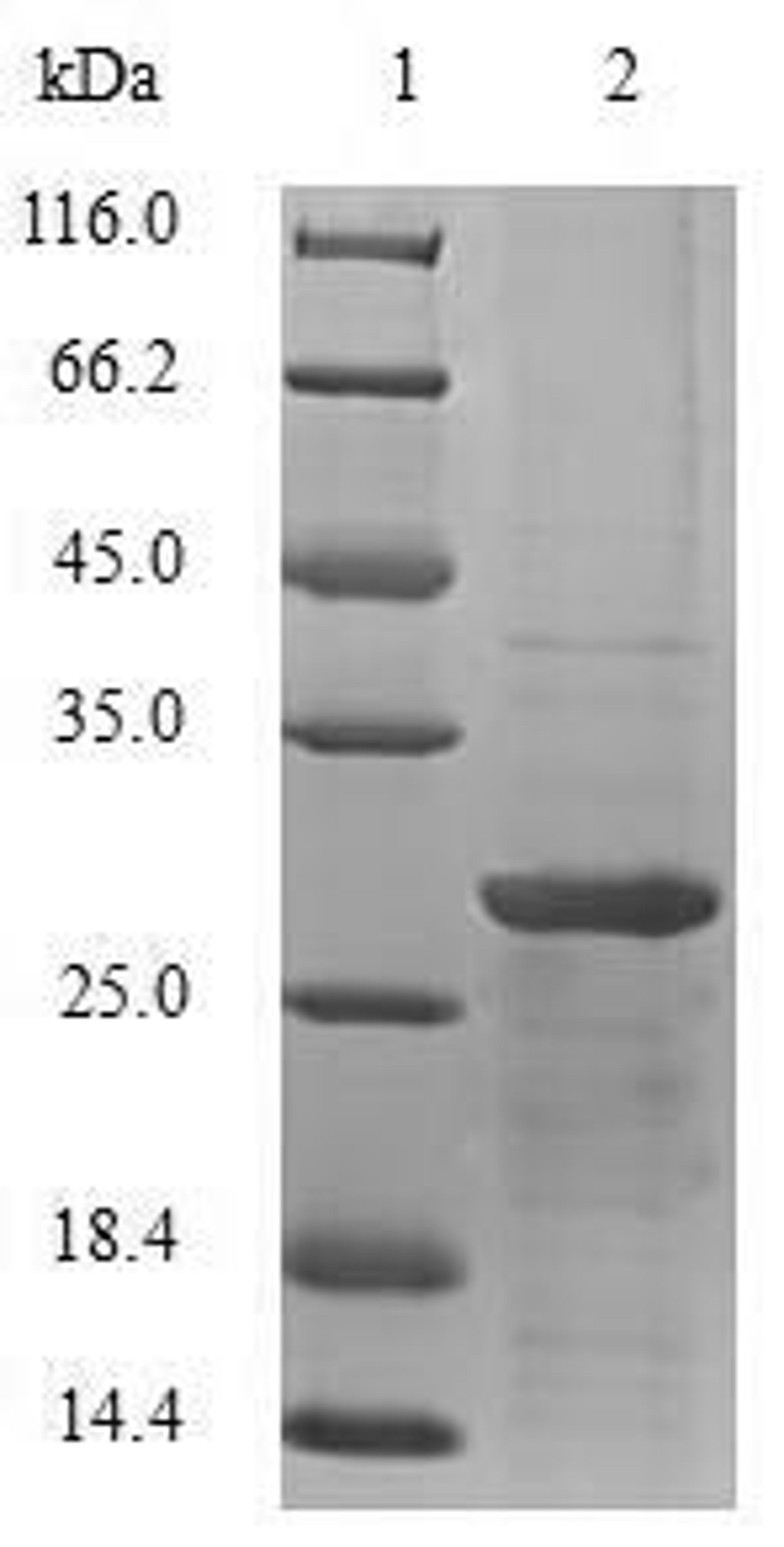 (Tris-Glycine gel) Discontinuous SDS-PAGE (reduced) with 5% enrichment gel and 15% separation gel.