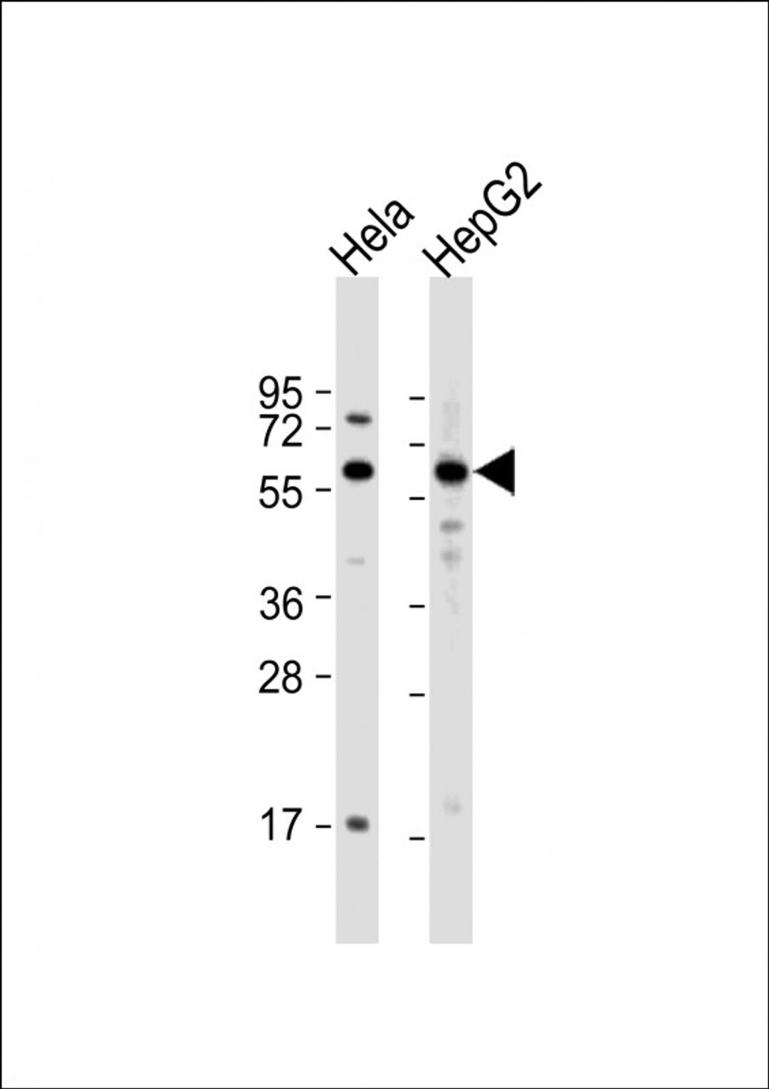 Western Blot at 1:1000 dilution Lane 1: Hela whole cell lysate Lane 2: HepG2 whole cell lysate Lysates/proteins at 20 ug per lane.