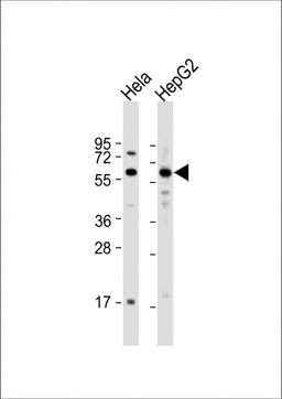 Western Blot at 1:1000 dilution Lane 1: Hela whole cell lysate Lane 2: HepG2 whole cell lysate Lysates/proteins at 20 ug per lane.