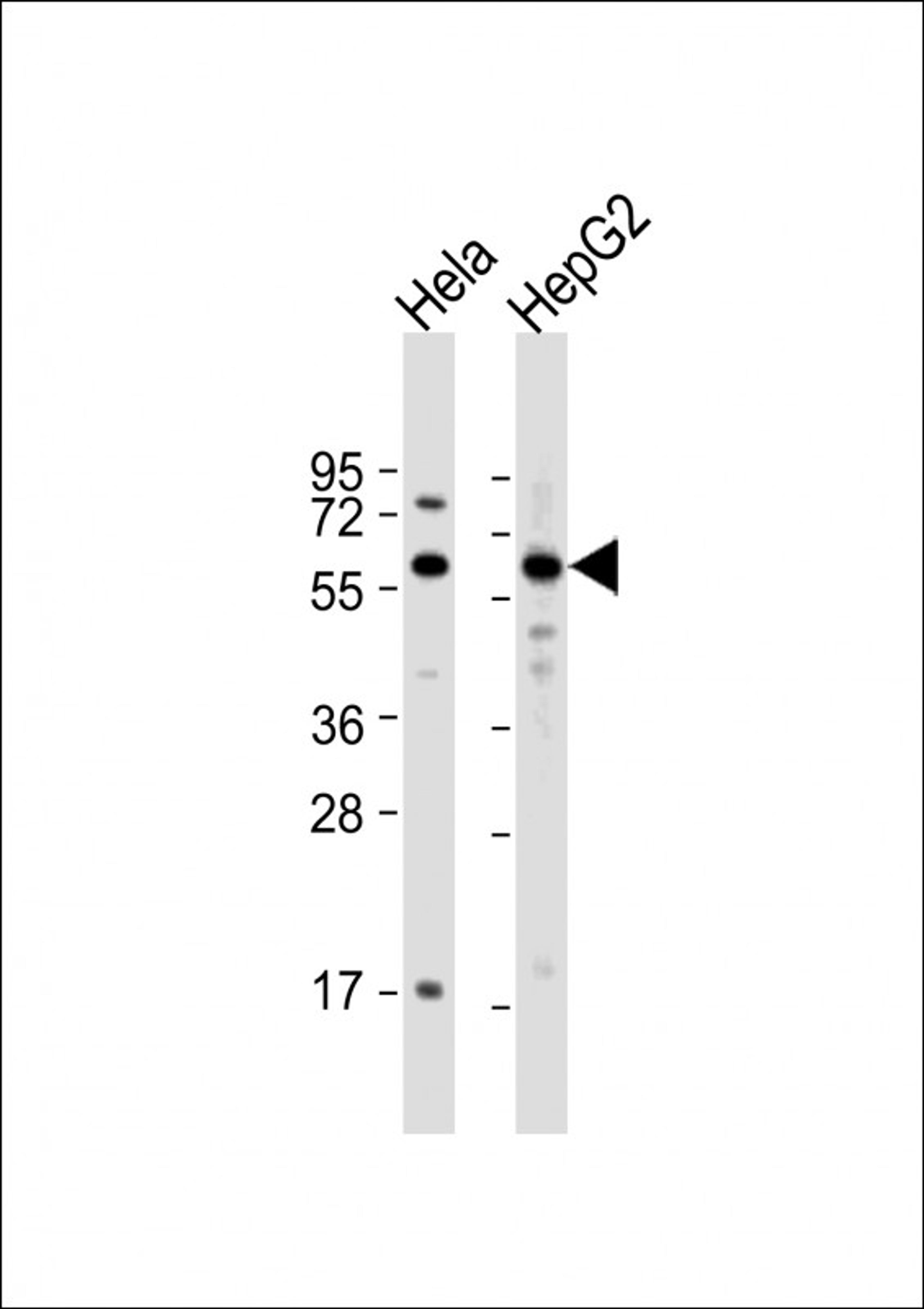 Western Blot at 1:1000 dilution Lane 1: Hela whole cell lysate Lane 2: HepG2 whole cell lysate Lysates/proteins at 20 ug per lane.