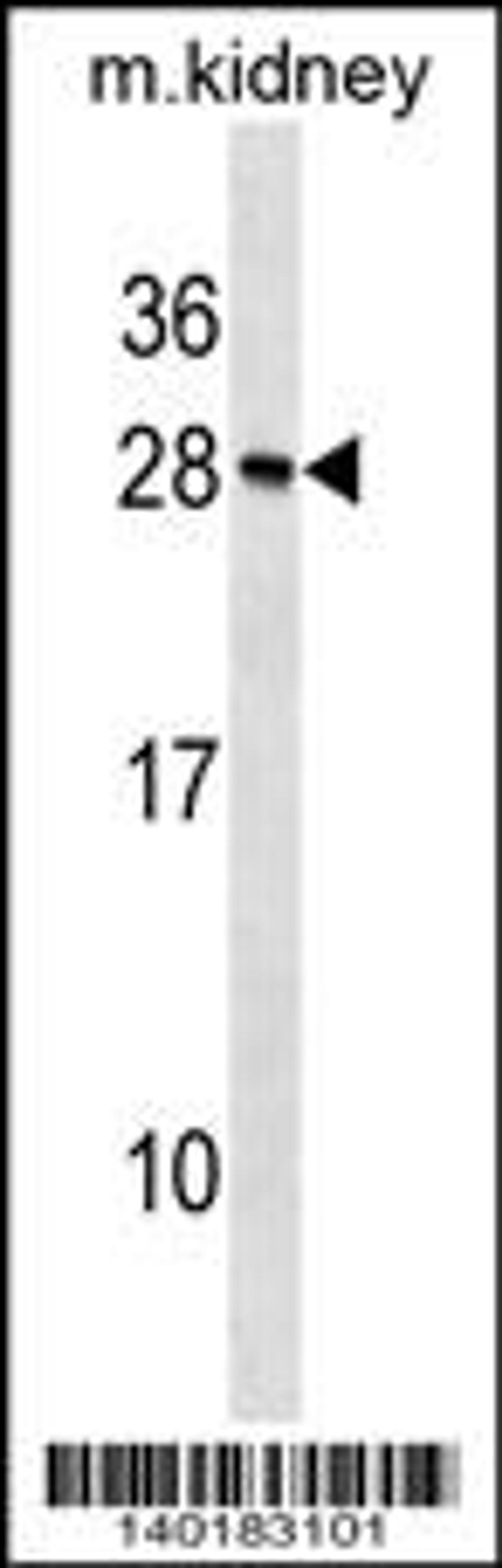 Western blot analysis in mouse kidney tissue lysates (35ug/lane).This demonstratesdetected the Rcvrn protein (arrow).