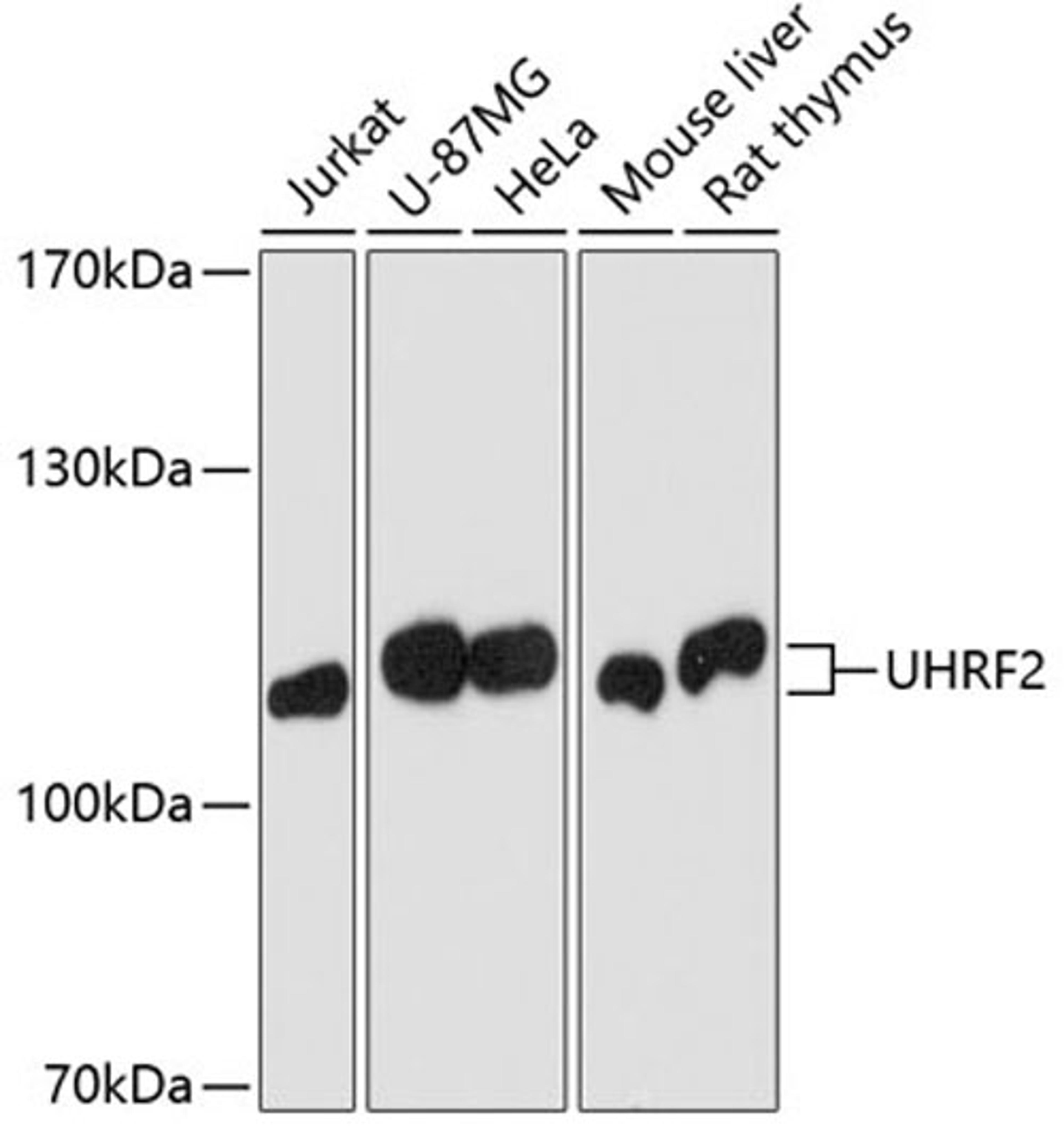 Western blot - UHRF2 antibody (A2344)