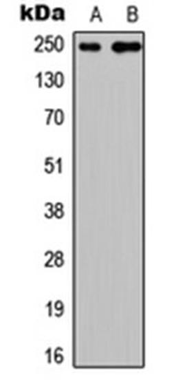 Western blot analysis of HEK293T (Lane 1), PC12 (Lane 2) whole cell lysates using CABIN1 antibody