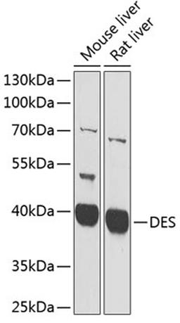 Western blot - DES antibody (A1116)