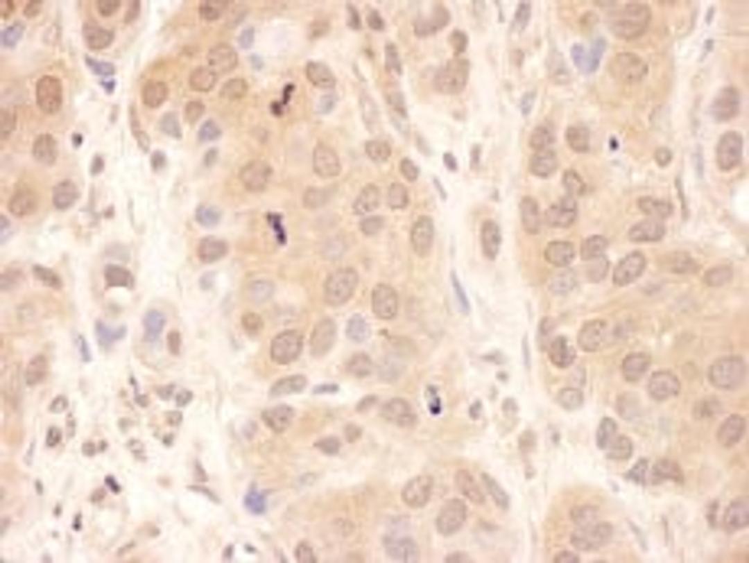 Detection of human USP8 by immunohistochemistry.