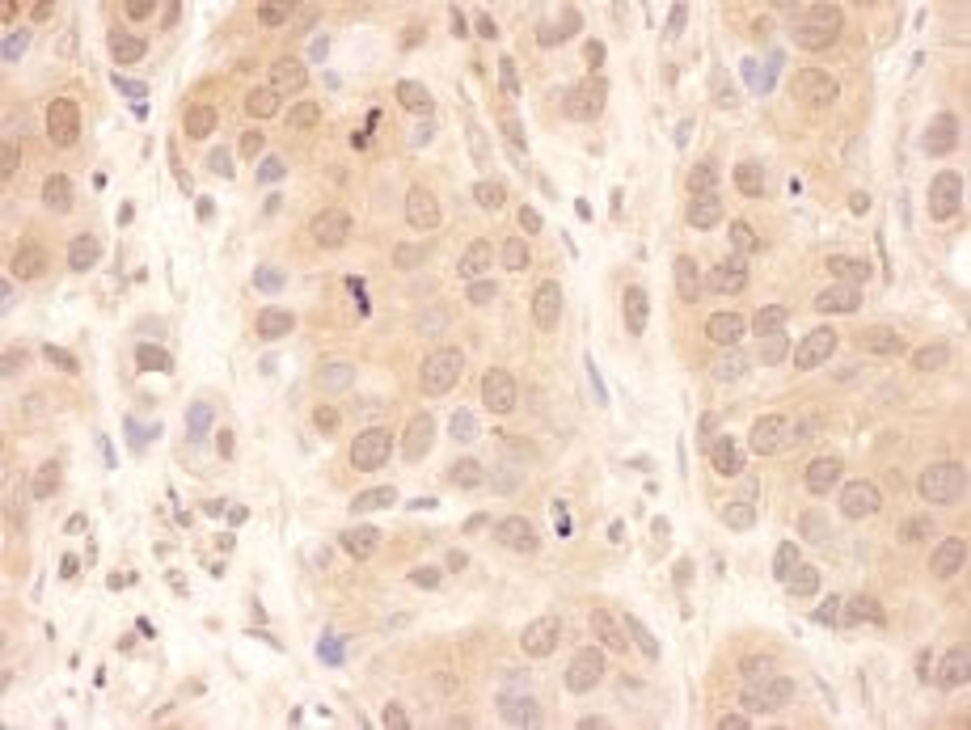 Detection of human USP8 by immunohistochemistry.