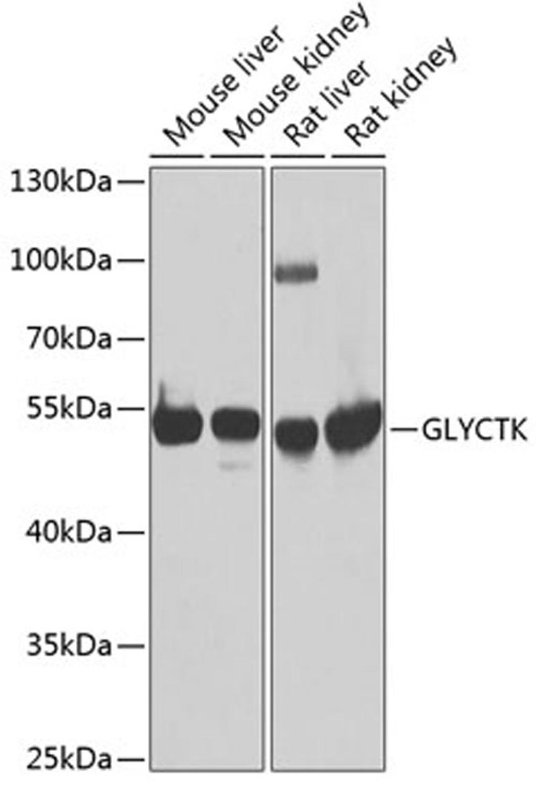 Western blot - GLYCTK antibody (A7852)