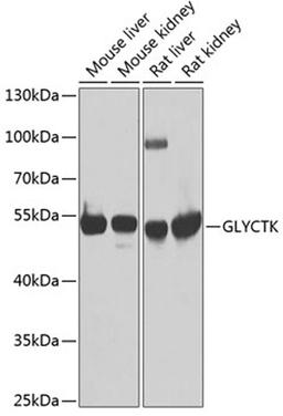 Western blot - GLYCTK antibody (A7852)