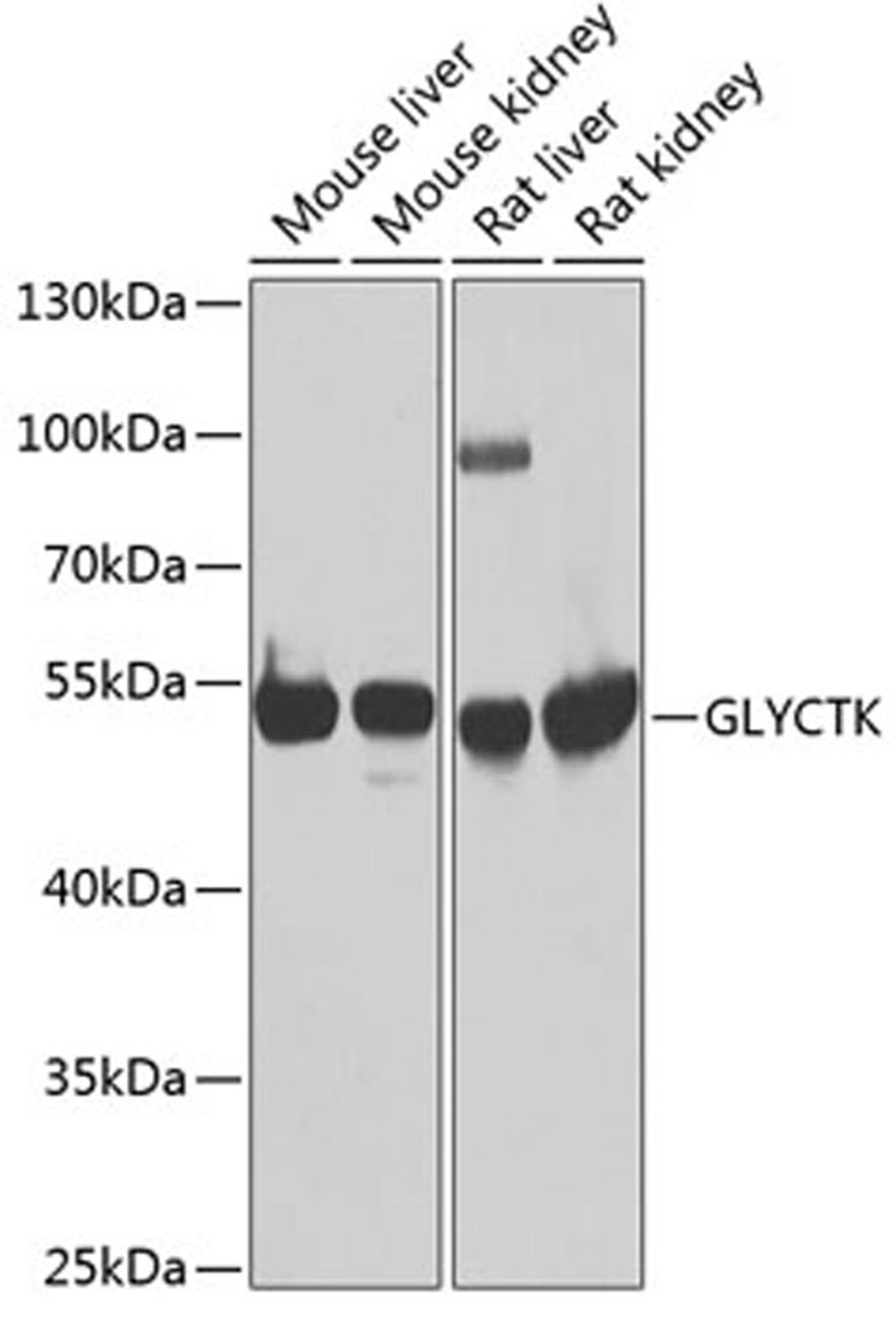 Western blot - GLYCTK antibody (A7852)