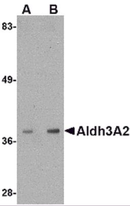 Western blot analysis of Aldh3A2 in mouse liver lysate with Aldh3A2 antibody at (A) 1 and (B) 2 &#956;g/mL.