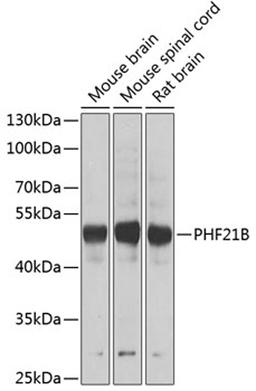 Western blot - PHF21B antibody (A7849)