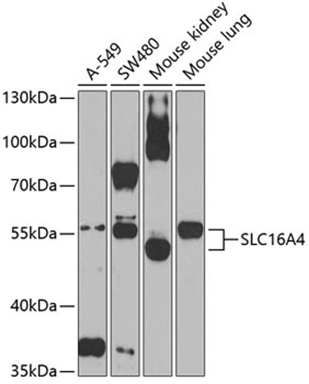 Western blot - SLC16A4 Antibody (A3016)