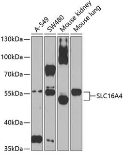 Western blot - SLC16A4 Antibody (A3016)