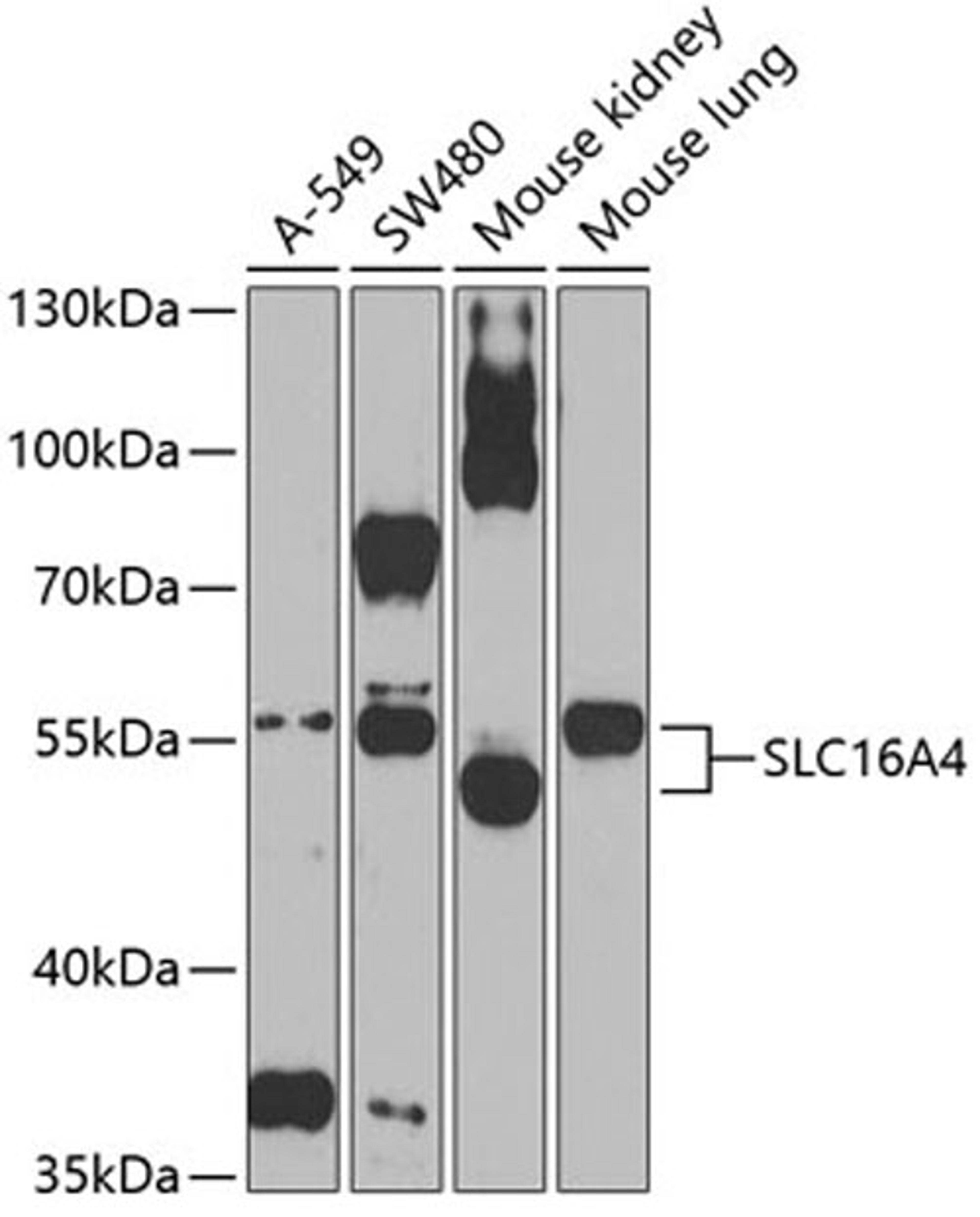 Western blot - SLC16A4 Antibody (A3016)