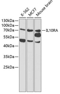 Western blot - IL10RA antibody (A1830)