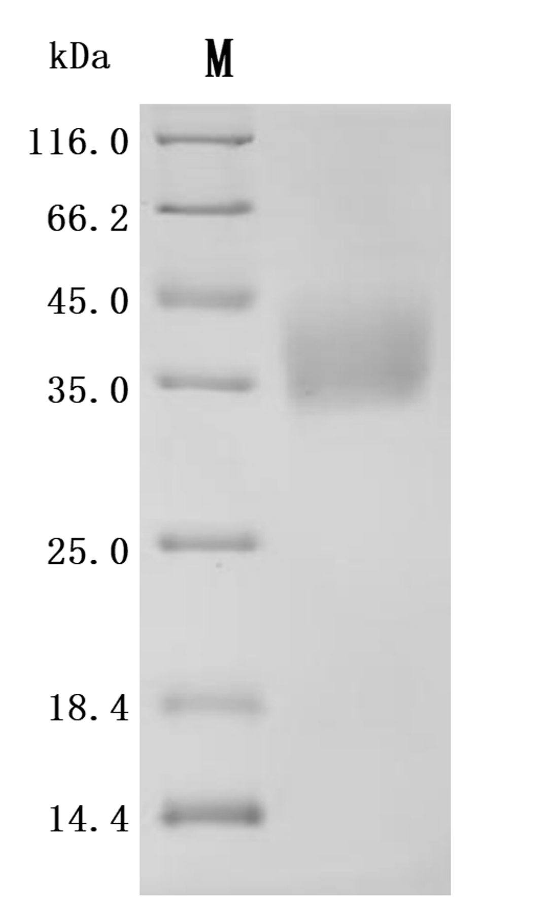 (Tris-Glycine gel) Discontinuous SDS-PAGE (reduced) with 5% enrichment gel and 15% separation gel.