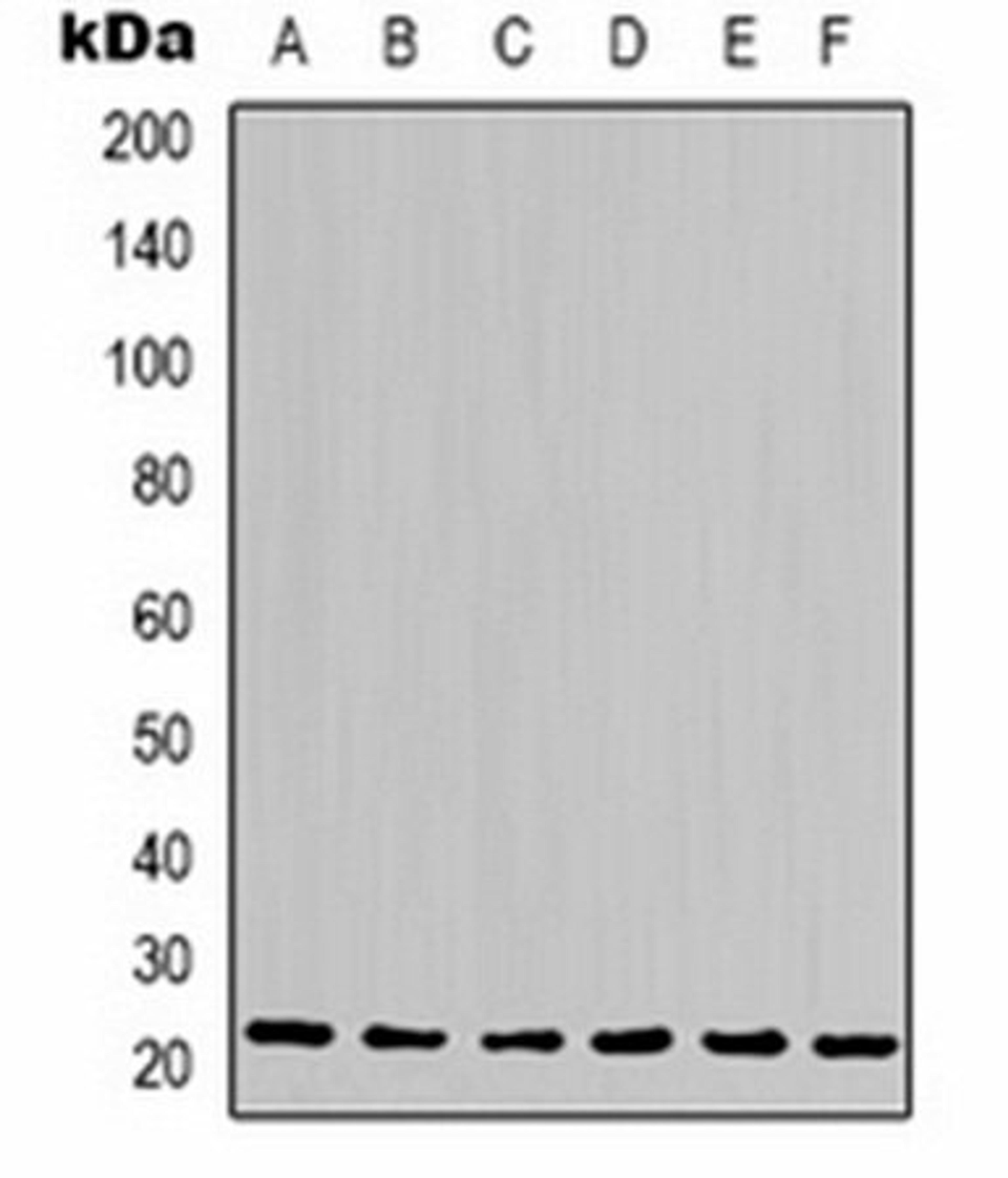 Western blot analysis of Hela (Lane 1), Jurkat (Lane 2), 293T (Lane 3), HepG2 (Lane 4), NIH3T3 (Lane 5), rat liver (Lane 6) whole cell lysates using Cyclophilin B antibody