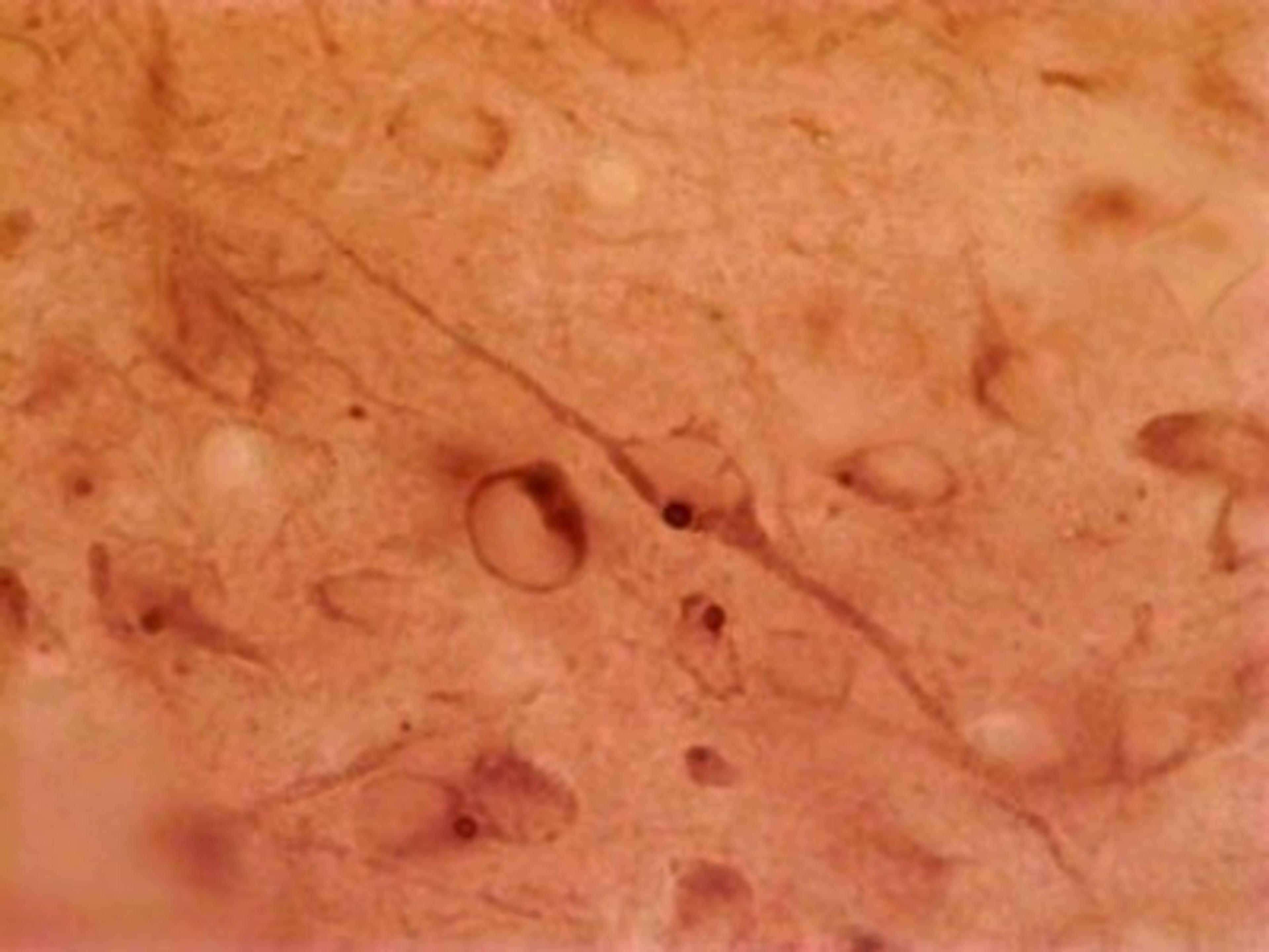 Immunohistochemistry: HAP1 Antibody (1B6) [NB110-74569] - Staining of rat hypothalamus.