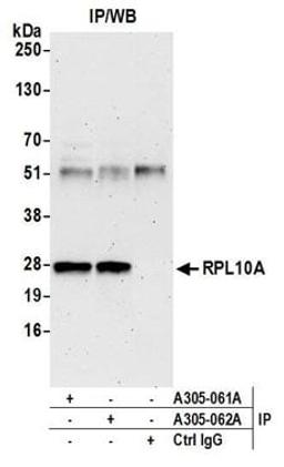 Detection of human RPL10A by western blot of immunoprecipitates.