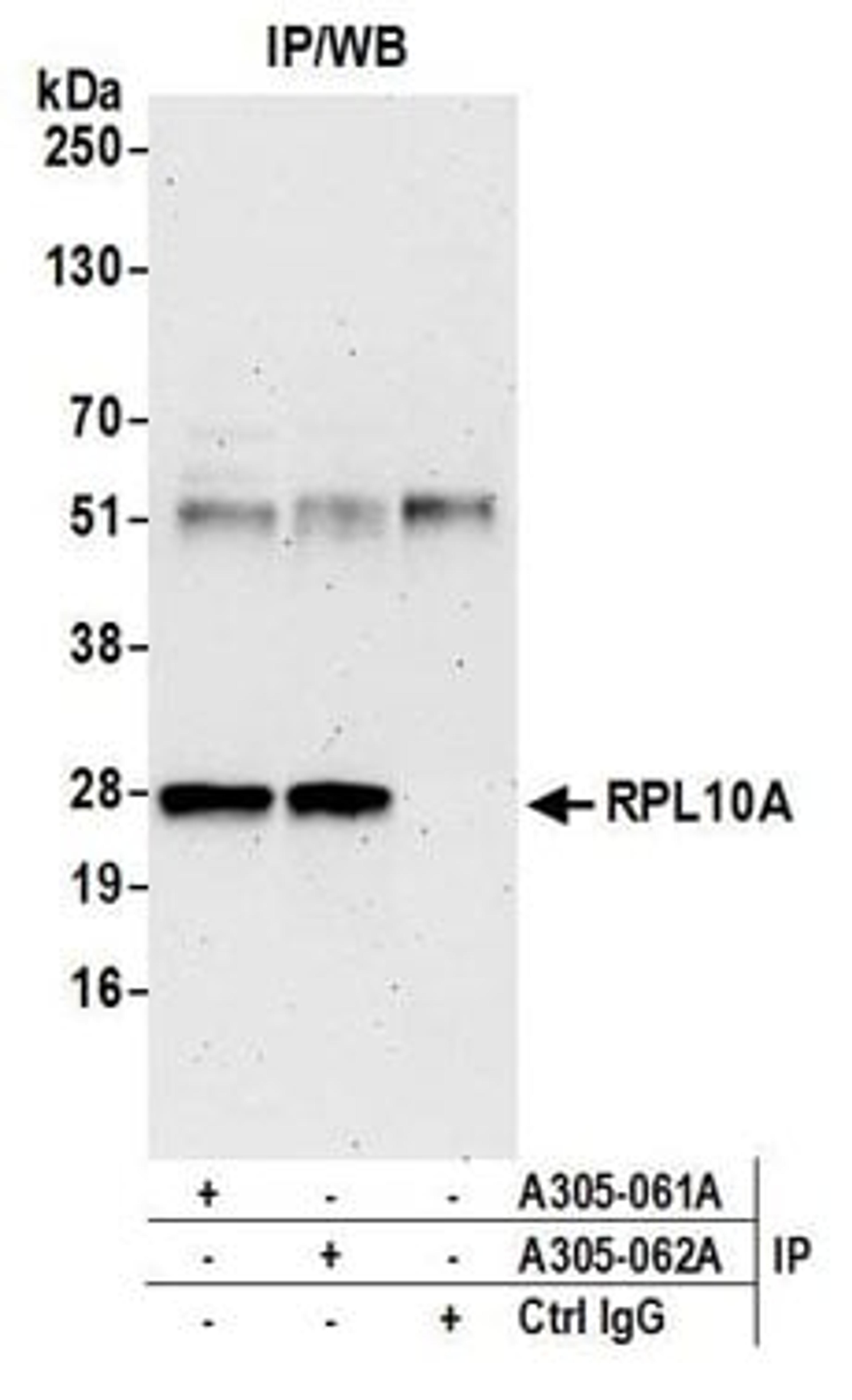 Detection of human RPL10A by western blot of immunoprecipitates.