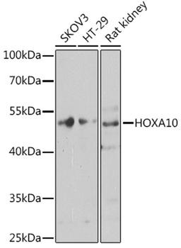 Western blot - HOXA10 antibody (A8550)