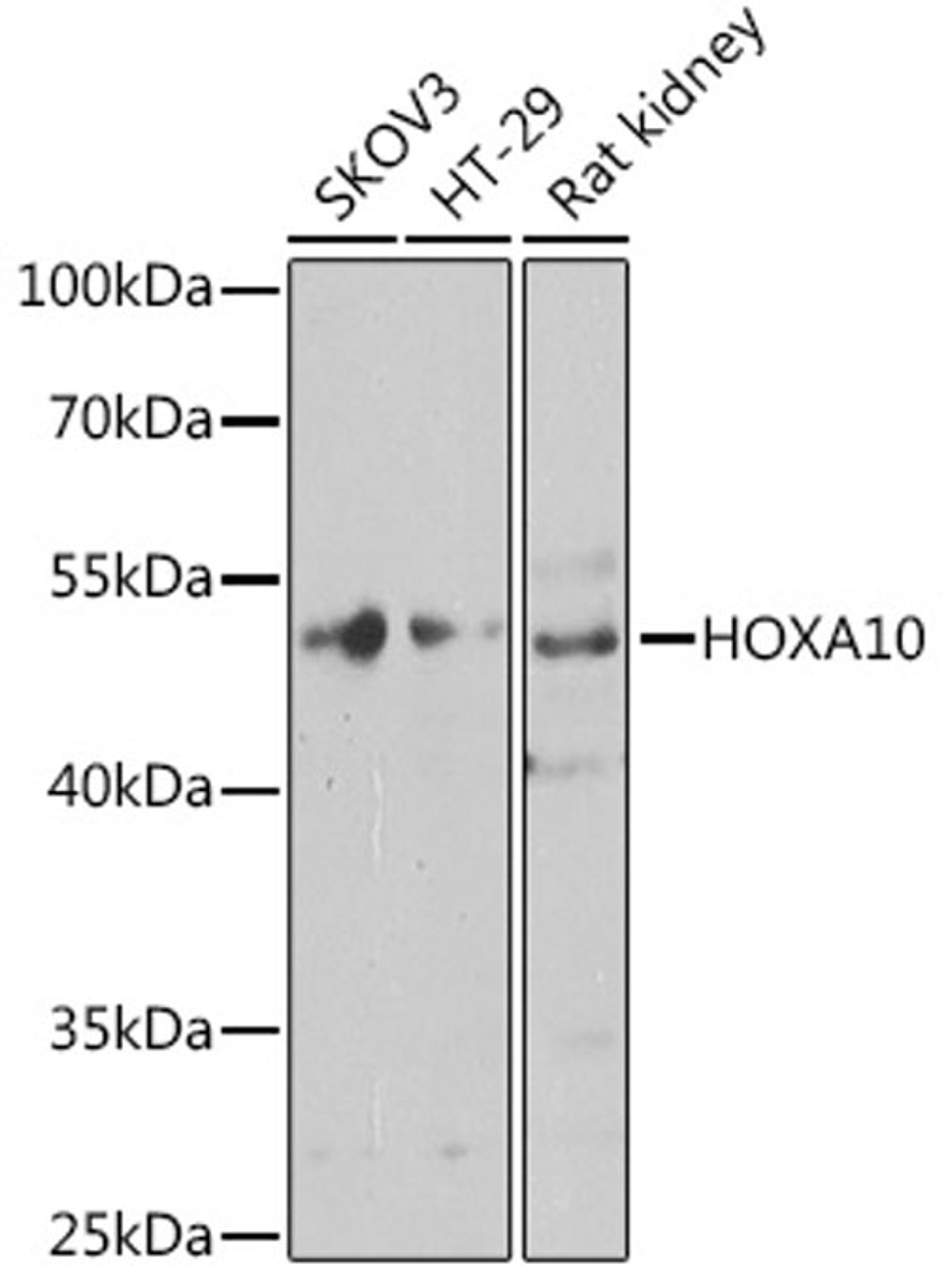 Western blot - HOXA10 antibody (A8550)