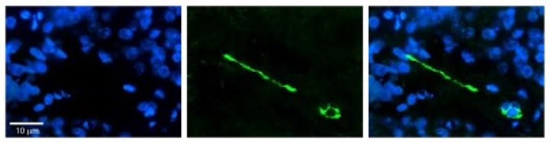 Immunocytochemistry/Immunofluorescence: MTUS1 Antibody [NBP1-60099] - Formalin Fixed Paraffin; Embedded Tissue: Human Pineal Tissue; Observed Staining: Cytoplasmic and membrane in cell bodies of pinealocytes and their processes; Primary Antibody Concentration: 1:100