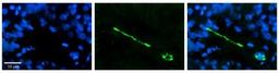 Immunocytochemistry/Immunofluorescence: MTUS1 Antibody [NBP1-60099] - Formalin Fixed Paraffin; Embedded Tissue: Human Pineal Tissue; Observed Staining: Cytoplasmic and membrane in cell bodies of pinealocytes and their processes; Primary Antibody Concentration: 1:100