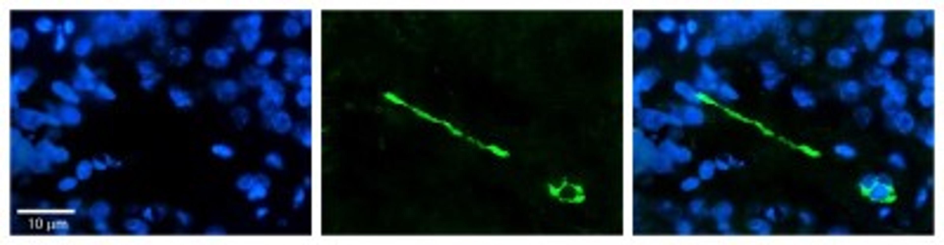 Immunocytochemistry/Immunofluorescence: MTUS1 Antibody [NBP1-60099] - Formalin Fixed Paraffin; Embedded Tissue: Human Pineal Tissue; Observed Staining: Cytoplasmic and membrane in cell bodies of pinealocytes and their processes; Primary Antibody Concentration: 1:100