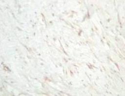 Immunohistochemistry: sFRP-1 Antibody [NBP1-02432] - Human dermal hypertrophic scar tissue.