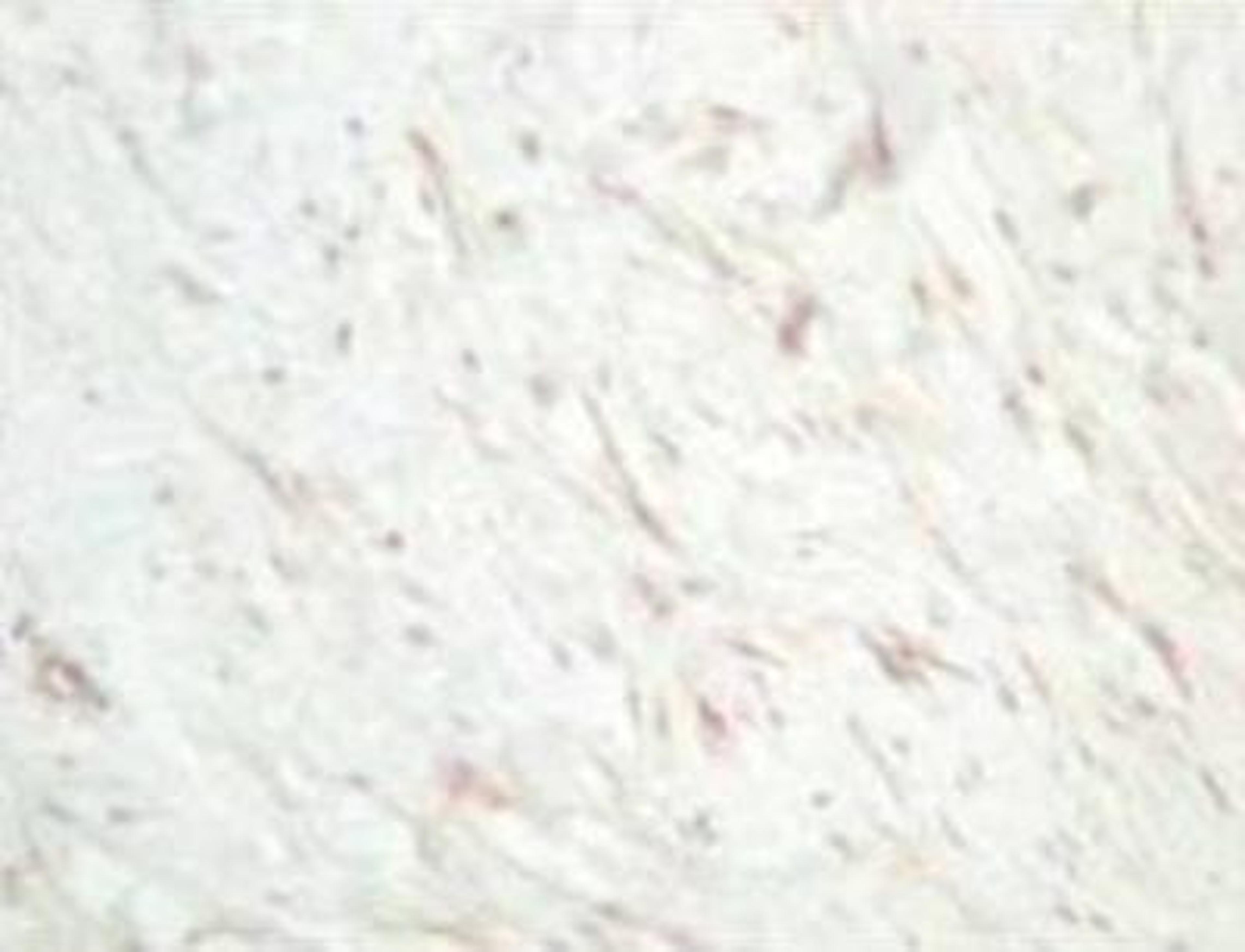 Immunohistochemistry: sFRP-1 Antibody [NBP1-02432] - Human dermal hypertrophic scar tissue.