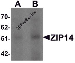 Western blot analysis of ZIP14 in human spleen tissue lysate with ZIP14 antibody at (A) 1 and (B) 2 μg/mL.
