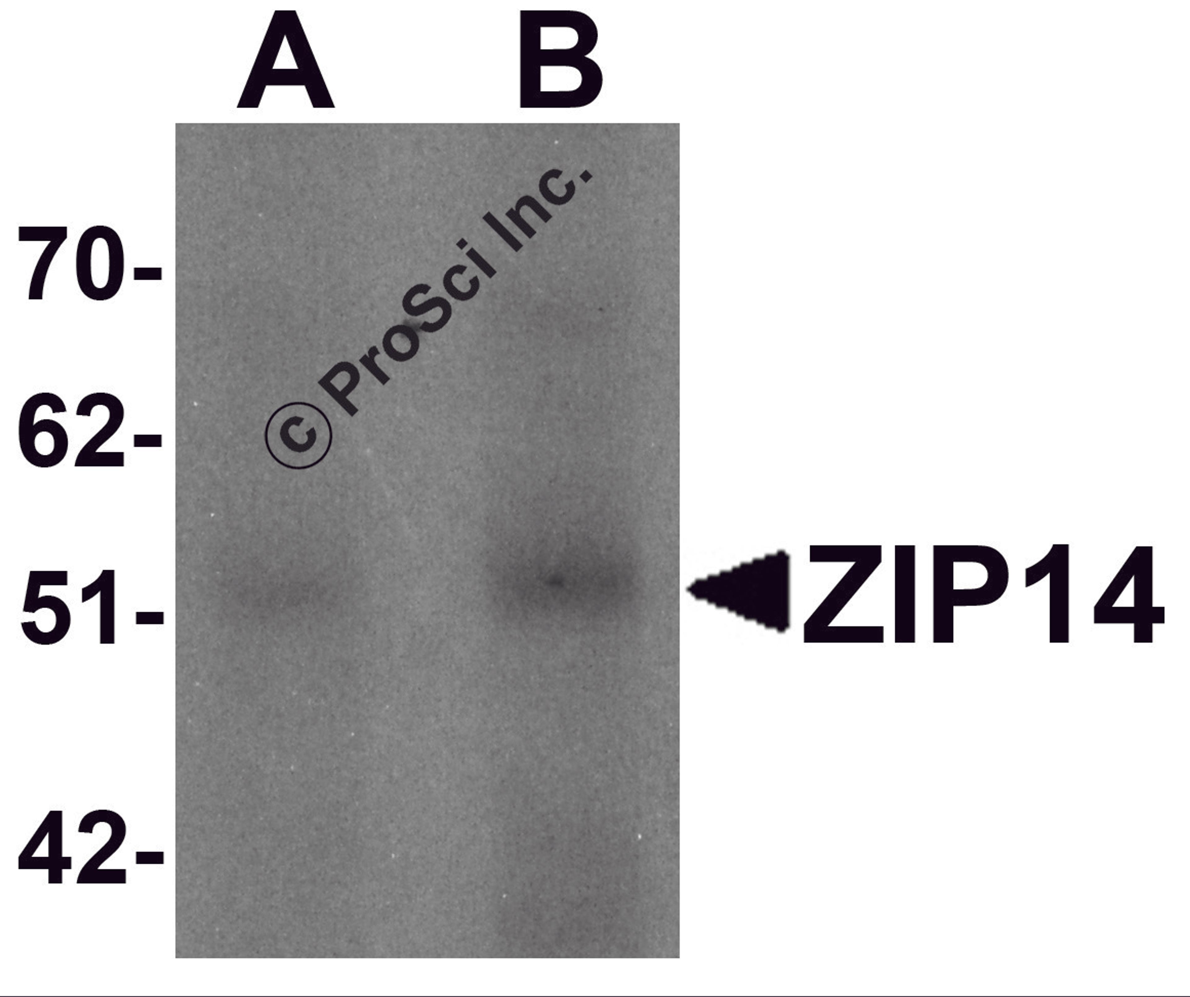 Western blot analysis of ZIP14 in human spleen tissue lysate with ZIP14 antibody at (A) 1 and (B) 2 μg/mL.