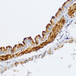 Immunohistochemistry  - MYLK Rabbit pAb (A8041)