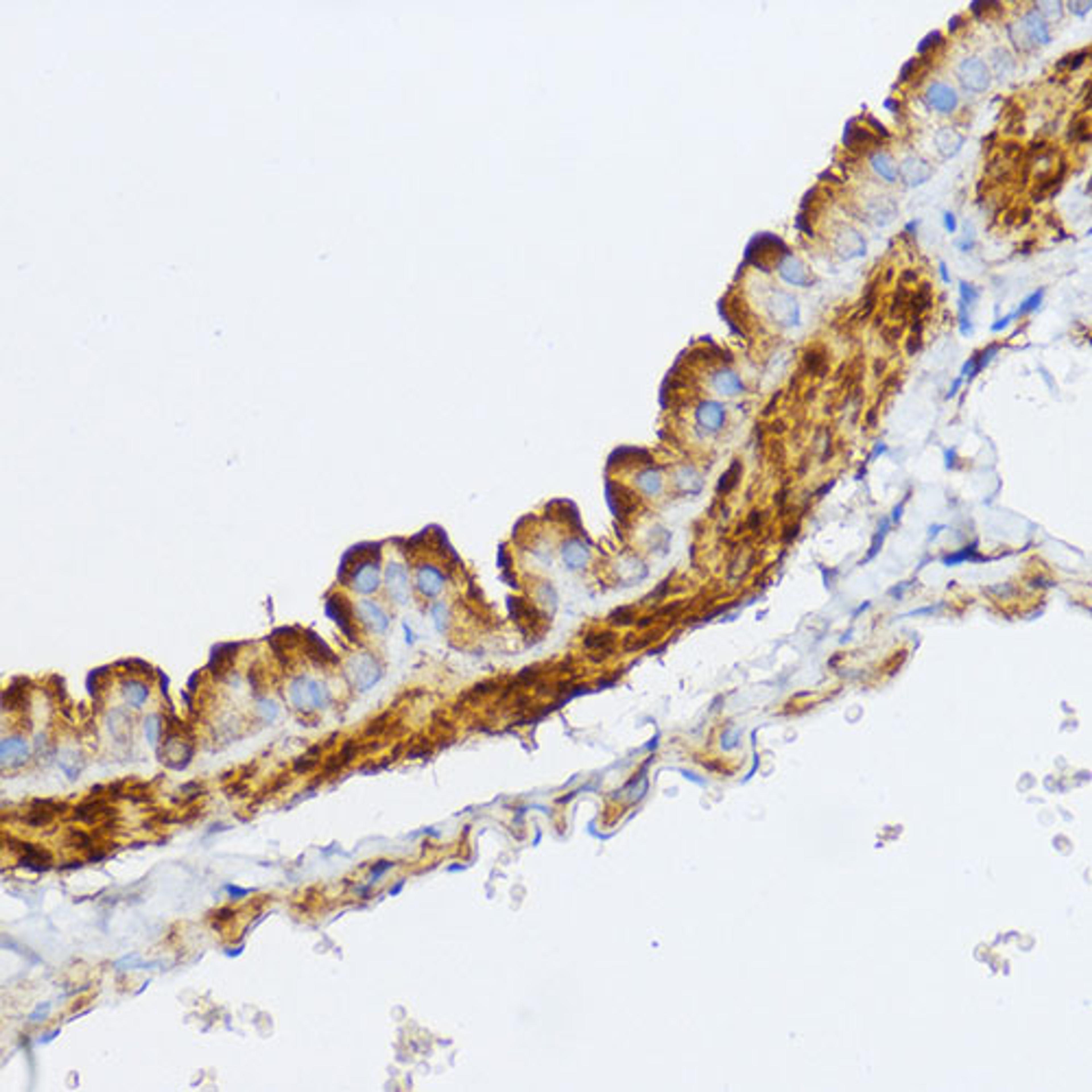 Immunohistochemistry - MYLK Rabbit pAb (A8041)