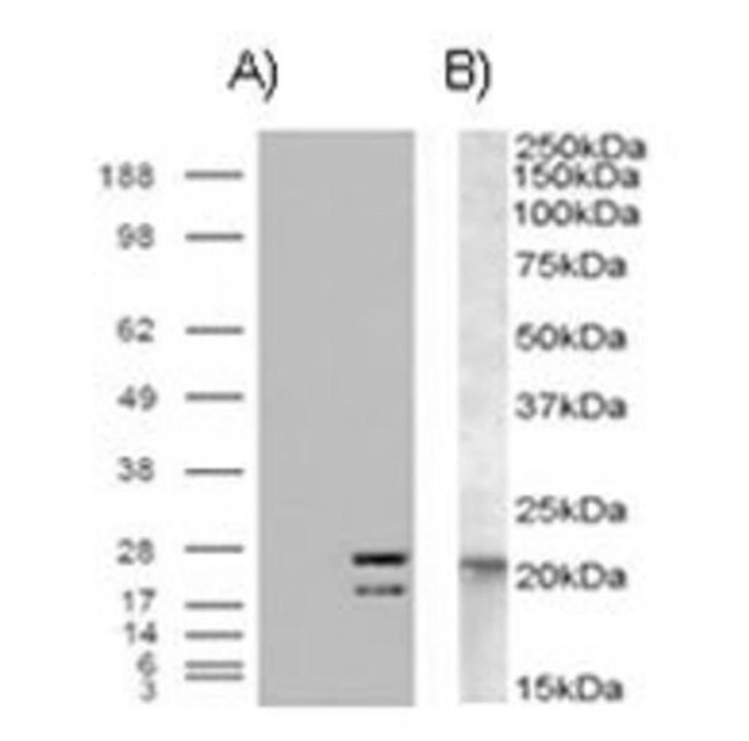 Western Blot: NRAS Antibody [NB100-94887] - A) HEK293 over expressing NRAS and probed with NRAS (mock transfection in first lane) B) (0.01ug/ml) staining of A431 lysate (35ug protein in RIPA buffer).Primary incubation was 1 hour. Detected by chemiluminescence.